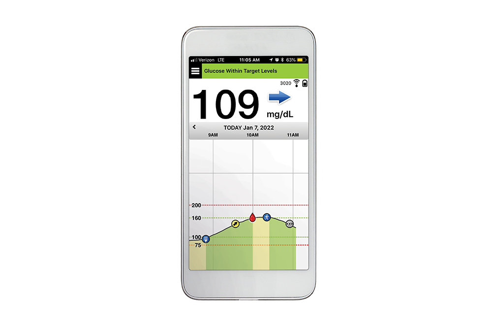 Phone screen depicting cgm technology on the Eversense system app. 