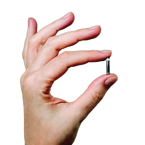 Hand met de Eversense E3-glucosesensor.