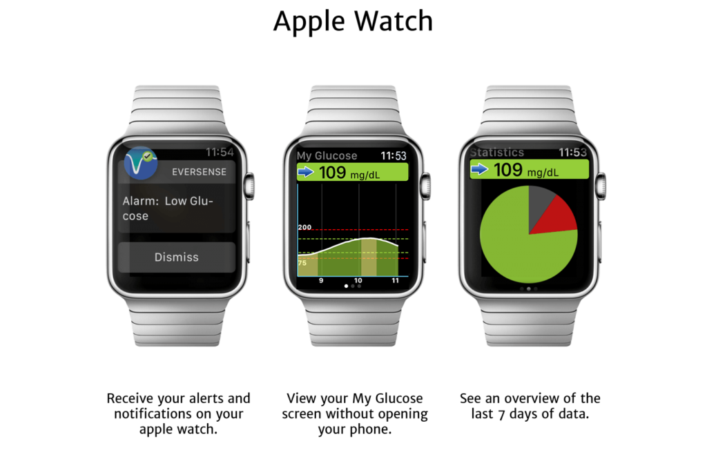 Eversense app voor Apple Watch